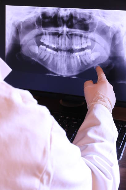 Best Emergency Tooth Extraction in Stephens City, VA